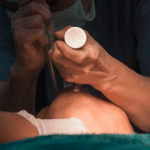 intubation leading to sickness